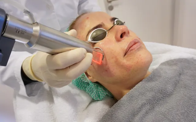 Fraktionierter CO₂-Laser in Düsseldorf: Schonende Hautverjüngung & Narbenbehandlung durch erfahrene Fachärzte Bild: Fraktionierter CO₂-Laser in Düsseldorf: Schonende Hautverjüngung & Narbenbehandlung durch erfahrene Fachärzte