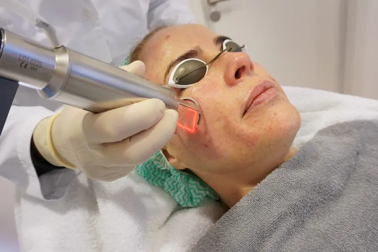 Bild: Fraktionierter CO₂-Laser in Düsseldorf: Schonende Hautverjüngung & Narbenbehandlung durch erfahrene Fachärzte