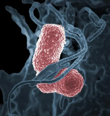 Bild: Veni Vidi Vici: Wie natürliche Killerzellen den Superbazillus Klebsiella besiegen