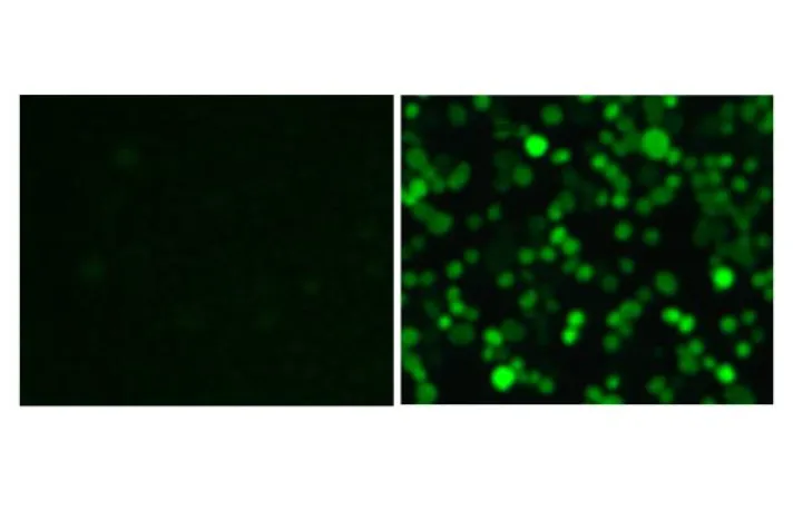 Bild: New receptor found on scavenger cells