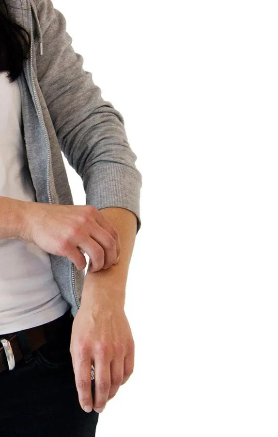 Die Hautkrankheit Neurodermitis ist ebenso belastend wie häufig