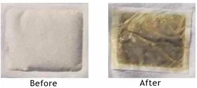 Bild: Die sanfte Reinigung des Körpers sollen japanische Baumessigpflaster fördern (Pharmazentral Nr. 7015447)