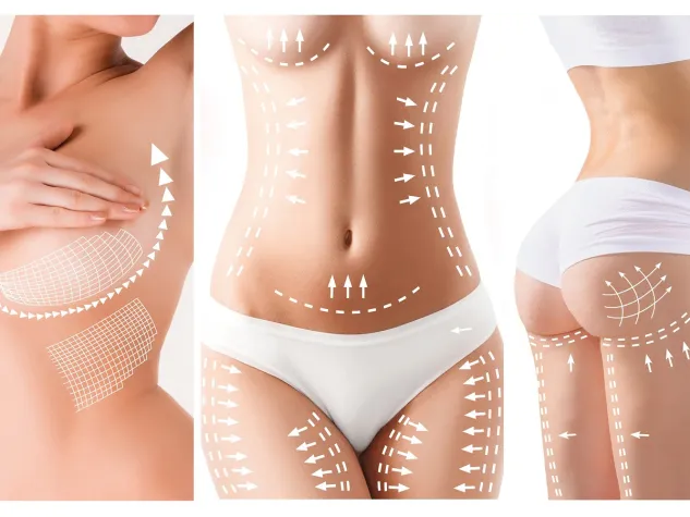 Bild: Schönheits-OP finanzieren mit einem Kredit bei BeFin