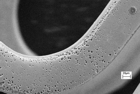 Bild: Stents aus neuen Metalllegierungen versprechen bessere Therapieerfolge bei der koronaren Herzkrankheit