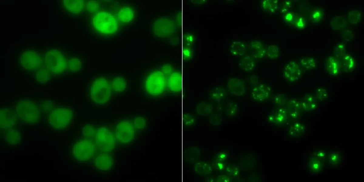 Hefezellen ohne Proteinaggregate (links) und solche mit (hell leuchtende Punkte): In Hungerzeiten dienen solche Klumpen als Zwischenlager für Proteine. (Gruppe Prof. Matthias Peter / ETH Zürich)