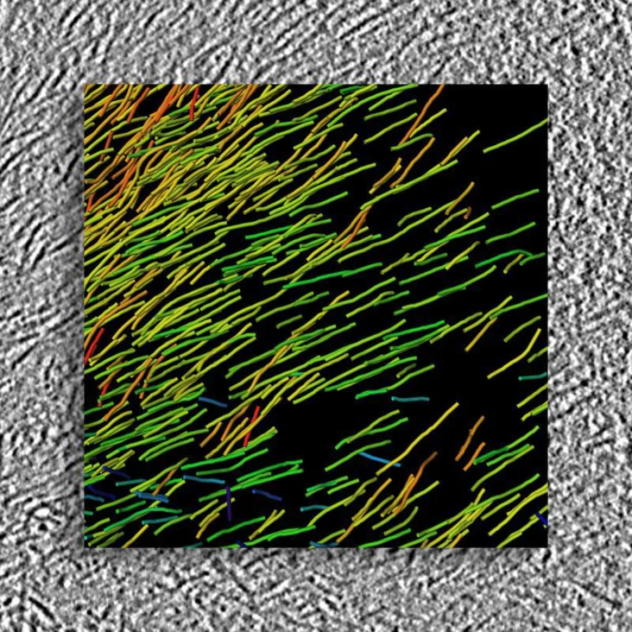 Mittels Kryoelektronentomographie wurde eine hochauflösende 3D-Struktur der Huntingtin-Aggregate erstellt. Hintergrund: Rohdaten, Vordergrund: 3D-Visualisierung (© MPI für Biochemie)