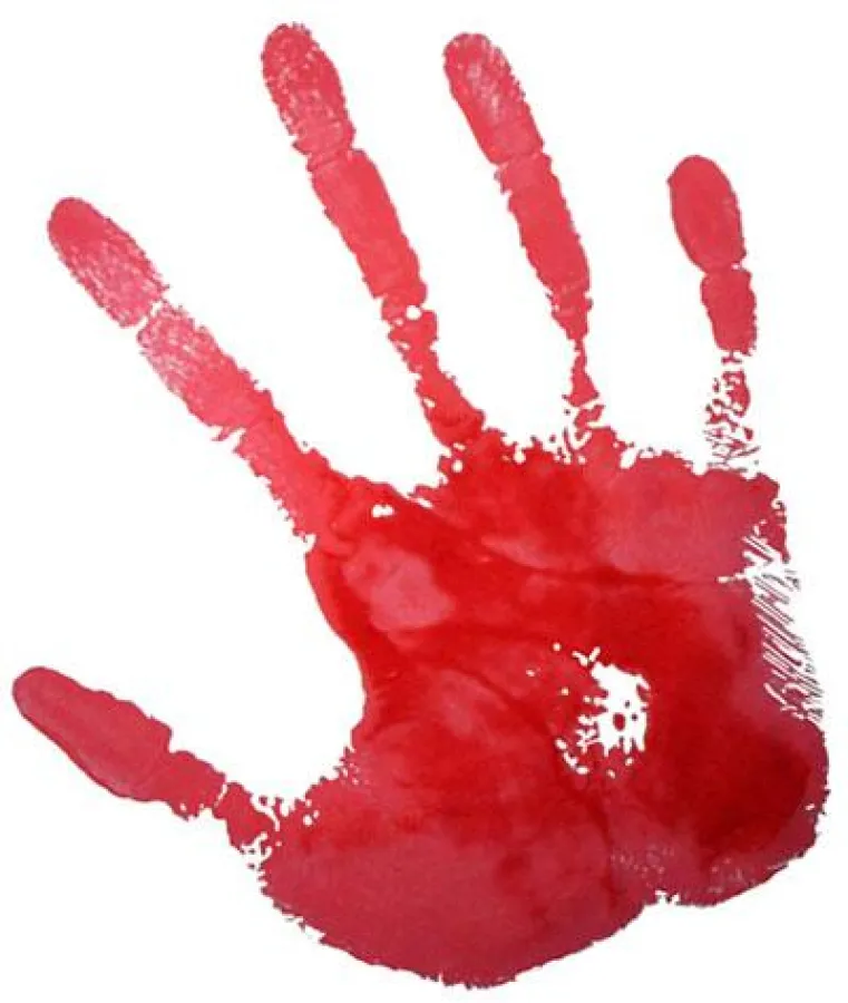 Redhand Day am 12. Februar