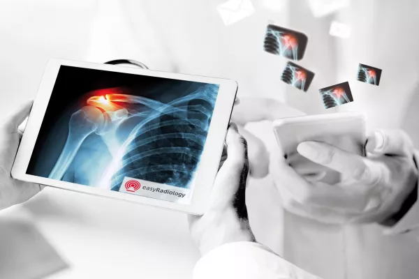 Bild: Im Jubiläumsjahr „125 Jahre Röntgenstrahlen“: EasyRadiology – der Abschied von der Patienten-CD