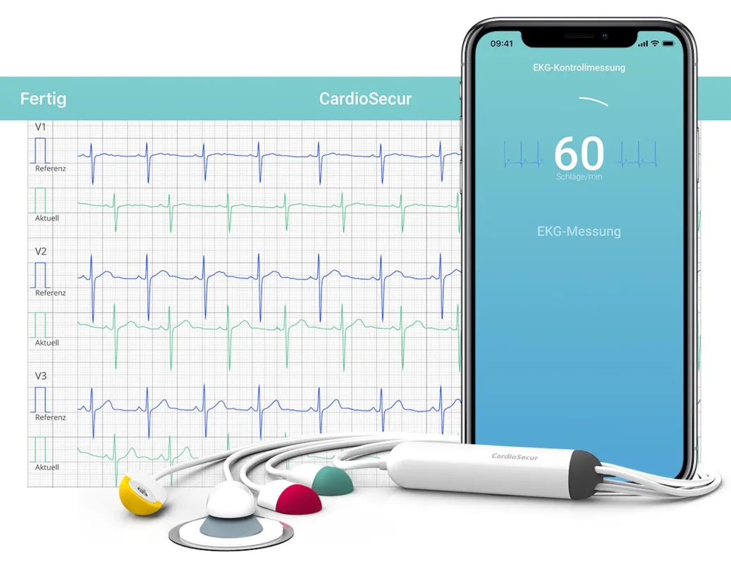 CardioSecur zeichnet ein klinisches EKG mit bis zu 22 Kanälen und nur 4 Elektroden auf. ©CardioSecur