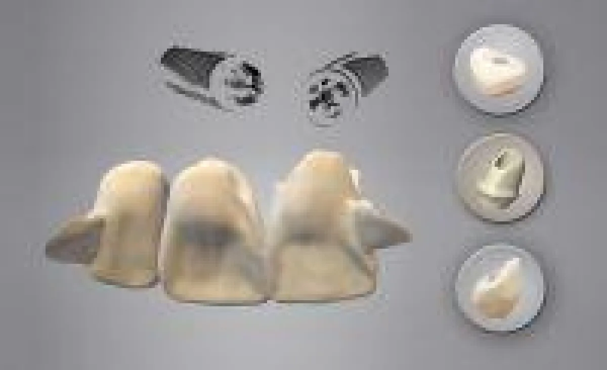 CADfirst Dental Fräszentrum Implantat-Provisorium