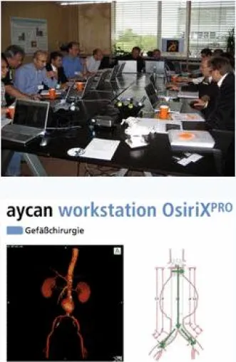 Bild: Erfolgreicher OsiriX PRO Hands-On Workshop für Gefäßchirurgen