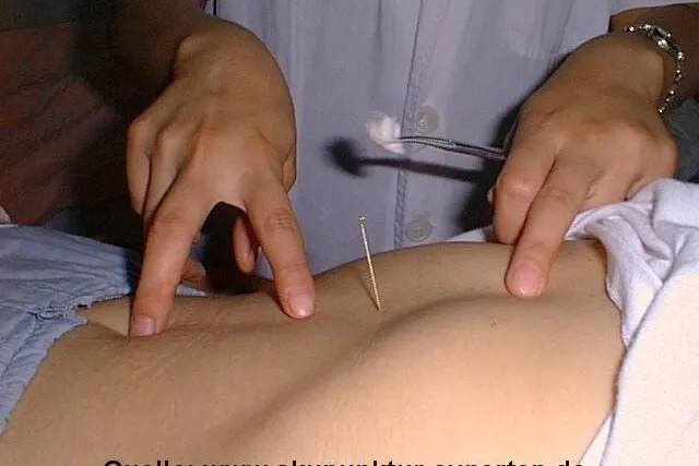 Bild: Termine Peking 2010 – Spezielle deutschsprachige Vollzeitkurse Akupunktur / TCM klinische Praxis und Theorie