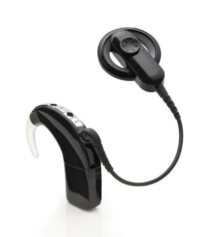 Kann nun von noch mehr CI-Trägern genutzt werden ? Nucleus 6 Soundprozessor (Foto: Cochlear Ltd.)