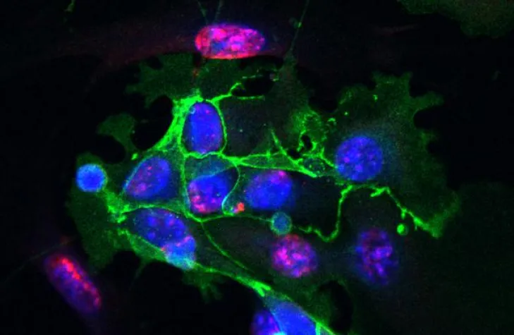 Bild: Cell aging in lung epithelial cells