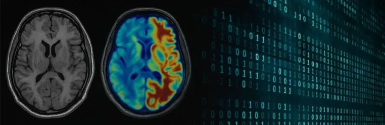 Neue Ära in der Diagnostik: mAInthink UDA Framework überwindet Domain Shift in der Bildgebung Bild: Neue Ära in der Diagnostik: mAInthink UDA Framework überwindet Domain Shift in der Bildgebung