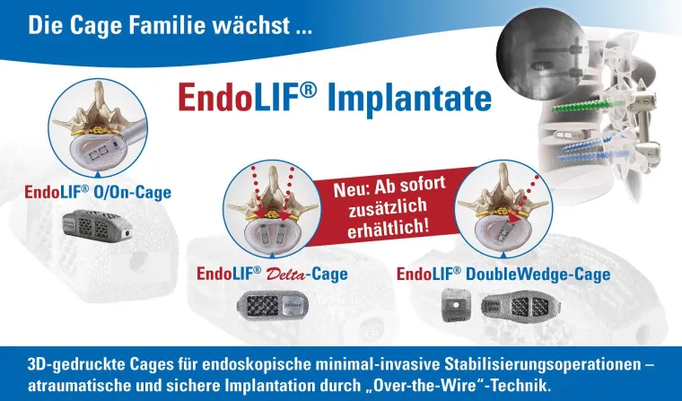 Bild: joimax® startet den offiziellen Verkauf seiner CE-geprüften EndoLIF® Produktlinie