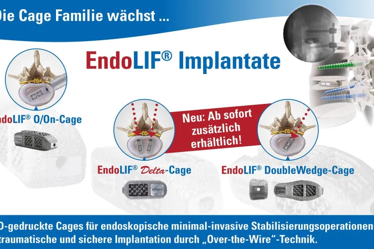 Bild: joimax® startet den offiziellen Verkauf seiner CE-geprüften EndoLIF® Produktlinie