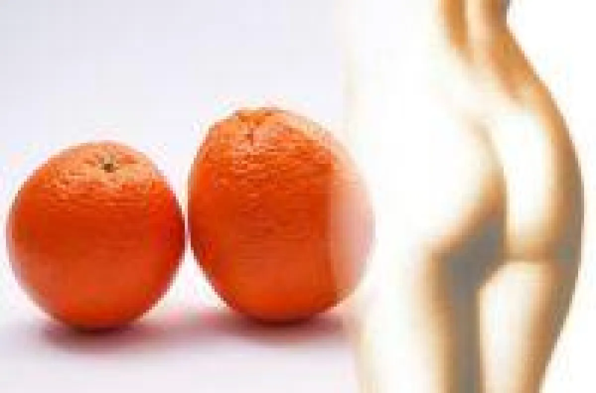 Was hilft gegen Cellulite