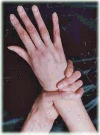 Bild: Marfan Hilfe – neue Website, noch mehr Aufklärung