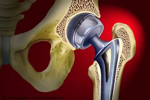 Bild: Orthopädische Arbeitsgemeinschaft für medizinische Illustration und anatomische Grafik