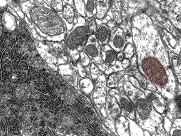 Bild: Why a Diabetes Drug Could Help in Parkinson’s  Disease