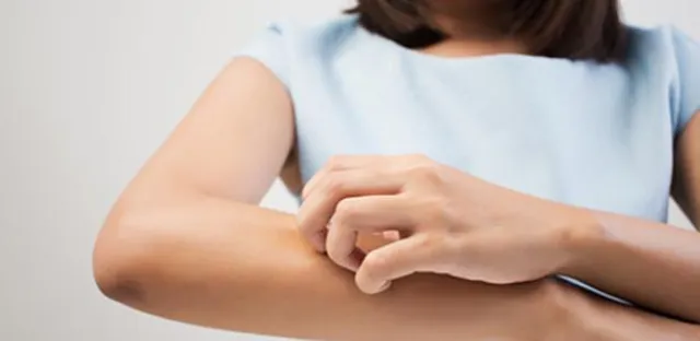 Bild: Vitamin D kann zum Schutz vor Ekzemen beitragen