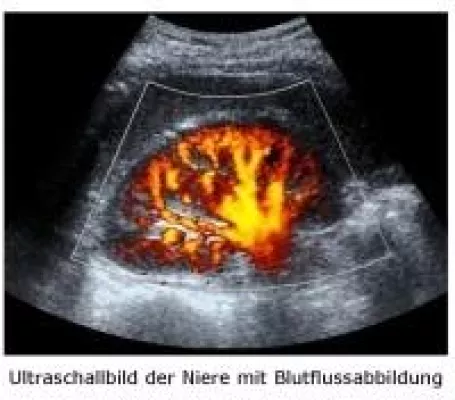 Bild: Diagnostische Ultraschallbildgebung