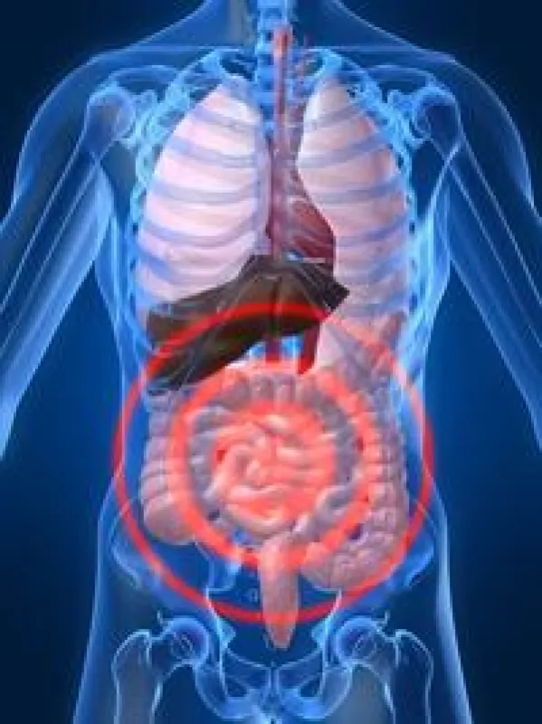 Colitis ulcerosa ist eine häufig auftretende Darmerkrankung