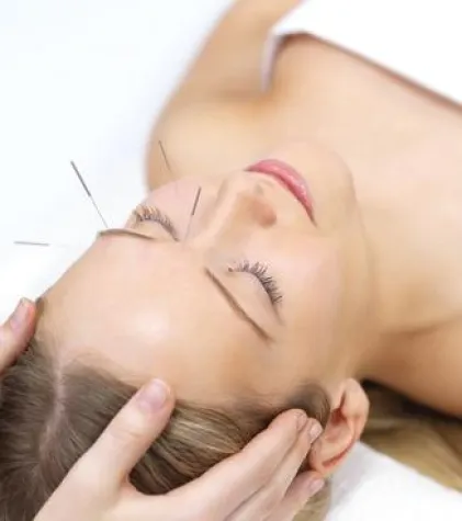 Bild: Akupunktur und TCM in der Geburtshilfe