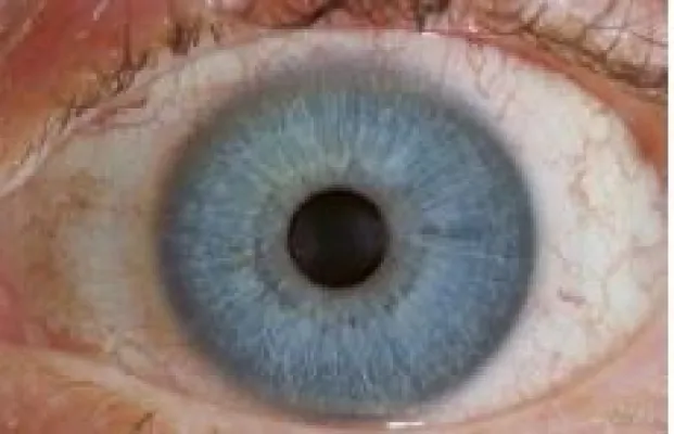 Bild: Iridologie - Was das Auge erzählt