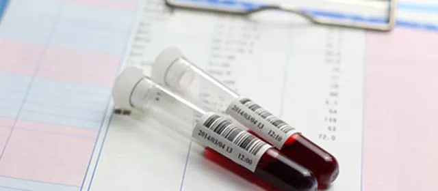 Bild: Zink kann die Blutfette verbessern