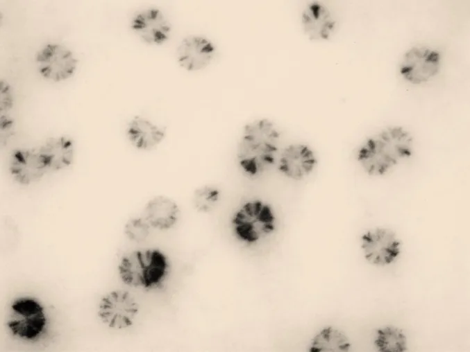 Bild: How the smallest bacterial pathogens outwit host immune defences by stealth mechanisms