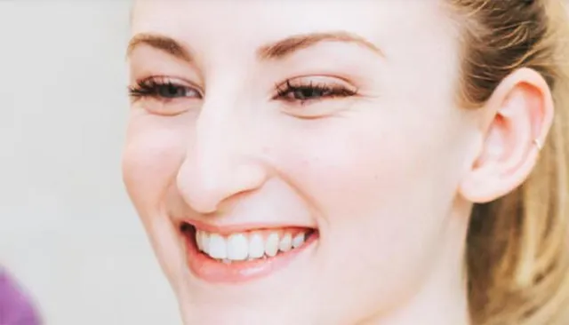 Bild: Neues Weiß fur verfarbte Zahne