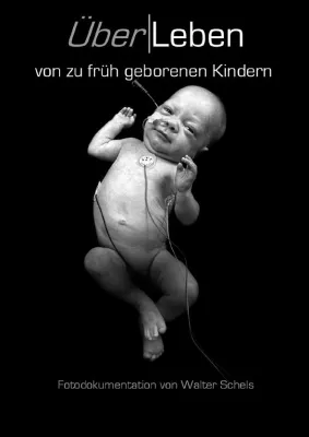 Bild: ÜberLeben - von zu früh geborenen Kindern