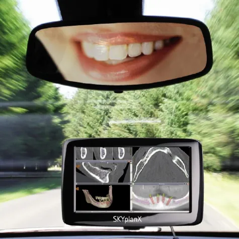 Zahnimplantation: bredent group mit Therapiekonzept „Navigierte Implantation“ Bild: Zahnimplantation: bredent group mit Therapiekonzept „Navigierte Implantation“