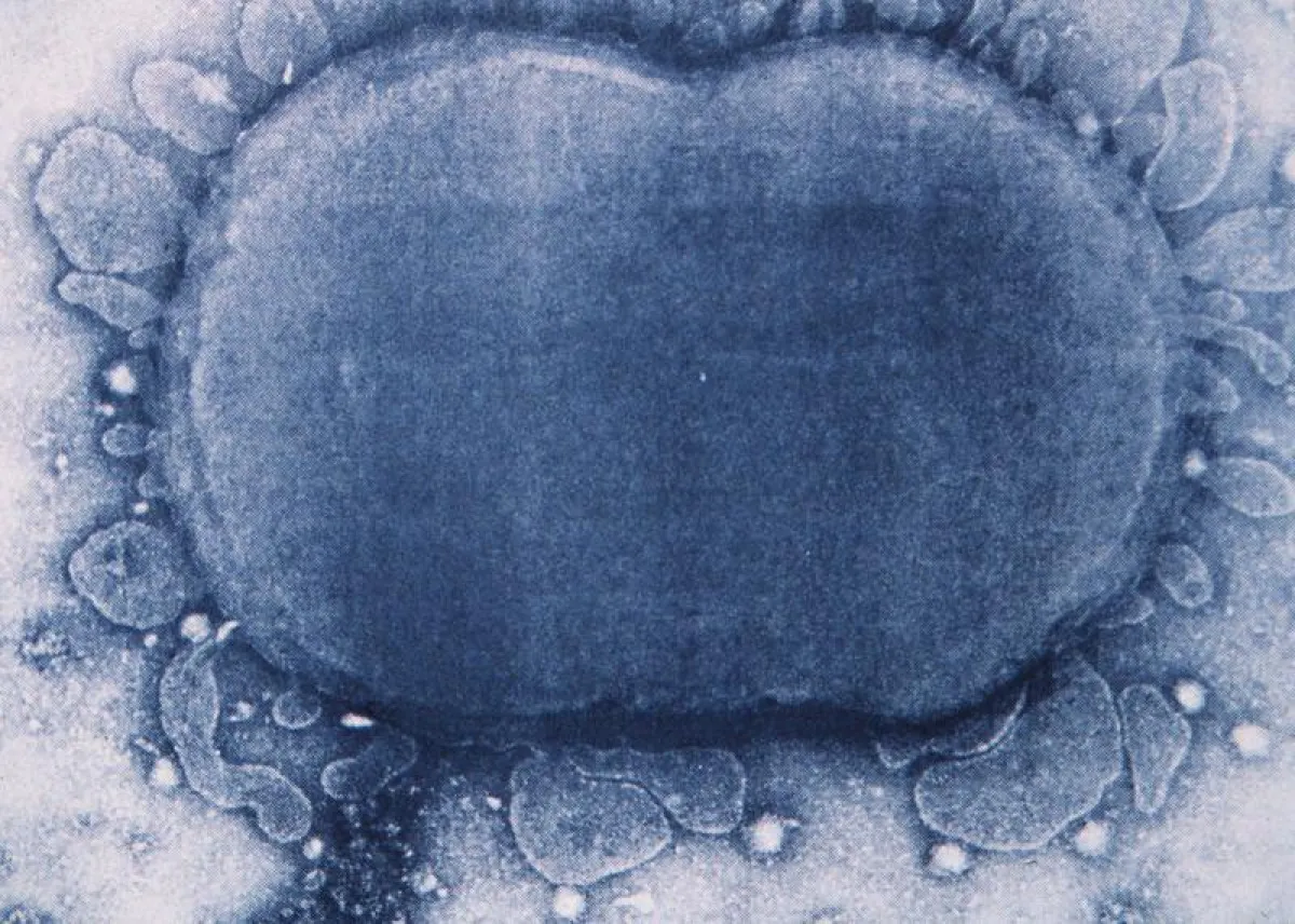 Sepsis can be caused for example by meningococcus. (Electron-microscopic image: Department of Paediatrics, Inselspital, Bern University Hospital)