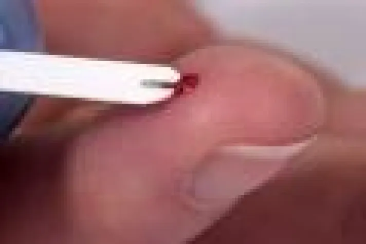 Bild: Diabetes und kein Ende in Sicht