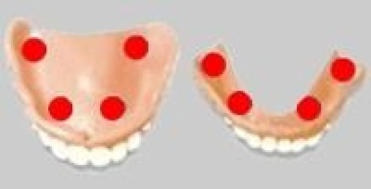 Nur vier erbsengroße Punkte der Haftcreme reichen