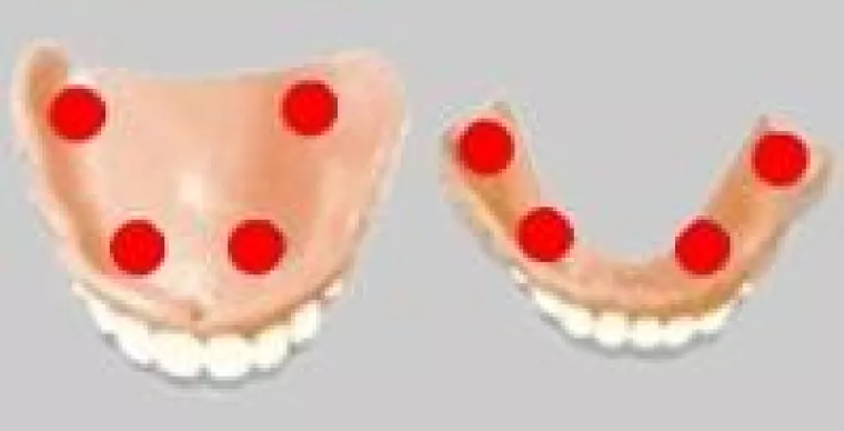 Superstarke Haftcreme von Bonyplus Bild: Superstarke Haftcreme von Bonyplus