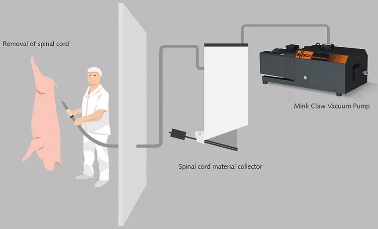 Bild: Sichere Entfernung von Rückenmark durch moderne Vakuumtechnik