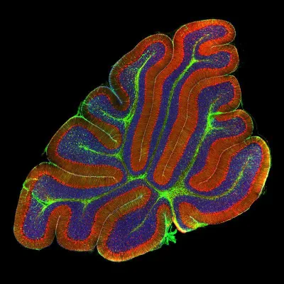 Gliazellen im Fokus von Neurowissenschaftlern - DFG-SPP 1757 nimmt Arbeit auf Bild: Gliazellen im Fokus von Neurowissenschaftlern - DFG-SPP 1757 nimmt Arbeit auf