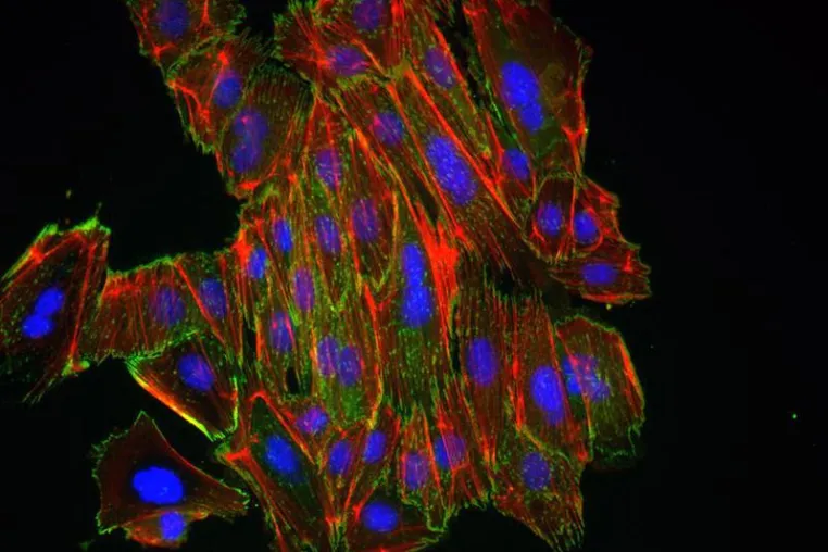 Bild: Newly Discovered microRNA Regulates Mobility of Tumor Cells